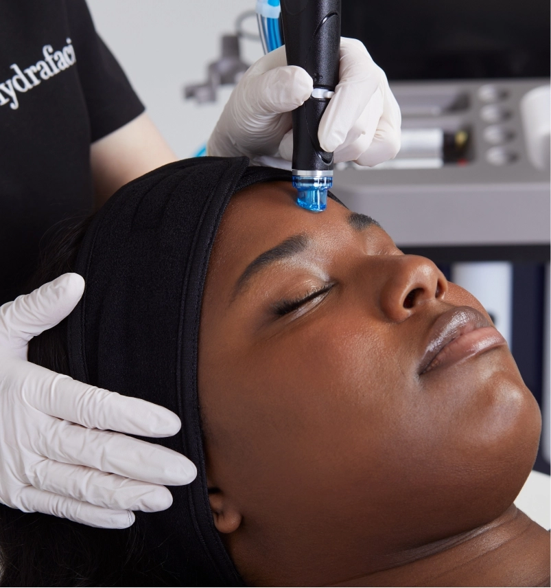 HydraFacial forehead treatment on a client with glowing skin at Etica Clinic