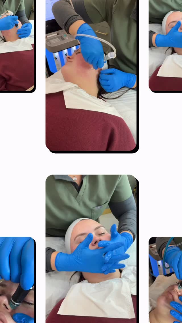 Nothing beats the feeling of fresh, radiant skin. Hydrafacial gives you that deep clean + glass-skin glow in just one session 💙✨
#HydraFacial #GlassSkin #SkinGoals #GlowBoost #BeautyClinic