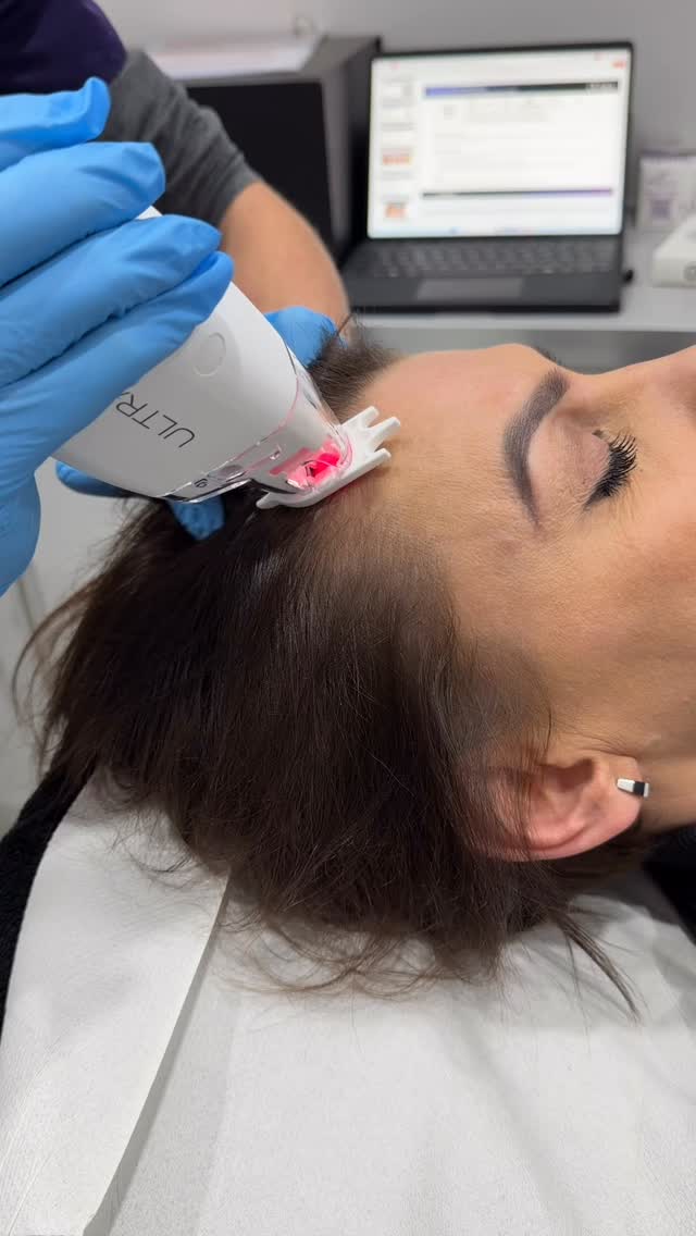 💆‍♀️ Benefits of LaseMD for Hair
✔️ Improves scalp health
✔️ Enhances absorption of hair growth serums
✔️ Supports thinning hair and weak follicles
✔️ Encourages fuller, thicker-looking hair
✔️ Non-invasive with minimal downtime

✨ Ideal for men and women experiencing thinning, shedding, or reduced hair density.

📩 DM us to find out if LaseMD for Hair is right for you and to book a consultation.

✨ Healthy scalp. Stronger hair. Confident you. ✨

#LaseMD
#HairRejuvenation
#ScalpHealth
#HairThinning
#MedicalAesthetics