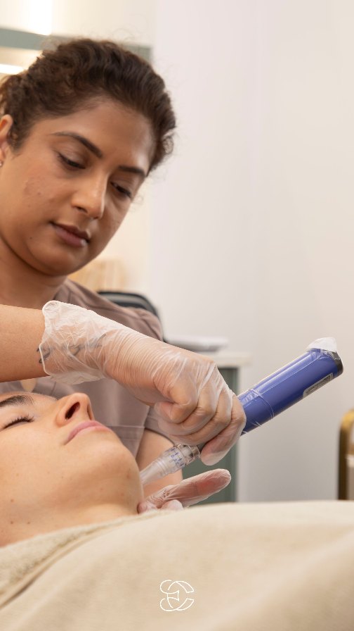 Full commitment to the most effective treatment to support long term skin quality ✨
At Etica Clinic we use SkinPen microneedling, a clinically proven treatment designed to stimulate collagen and elastin production by creating controlled micro channels in the skin.
This natural regeneration process helps improve:
• fine lines and early signs of ageing
• acne scars and uneven texture
• enlarged pores
• dull or tired looking skin
• overall skin firmness and smoothness
Over time, your skin becomes stronger, smoother, and more resilient.
If your goal is healthy, youthful skin that continues to improve year after year, microneedling is one of the treatments worth adding to your routine.
💌 Book your consultation at Etica Clinic to discover if SkinPen microneedling is right for your skin.
📍Available at Etica Clinic, Eastcote and Northwood
.
#aestheticclinic #microneedling #skinpenmicroneedling #microneedlingtreatment #collagenstimulation