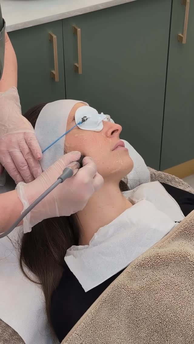 Lift, tighten, glow ✨

Radio Frequency is virtually pain-free and boosts collagen deep within the skin—leaving you with smoother, firmer, more youthful-looking skin.

For best results: once a week, 6–8 sessions recommended 💫
DM for pricing 📩

#RadioFrequency #SkinTightening #CollagenBoost #glowskin