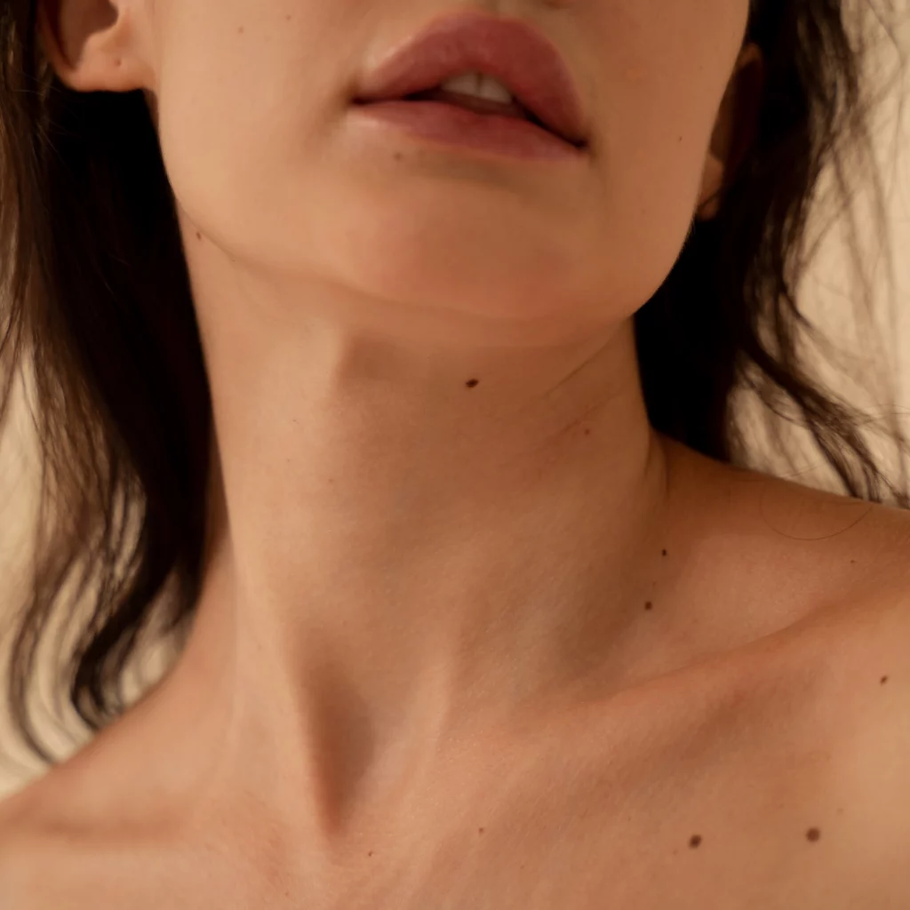 CryoPen treatment for skin lesion removal at Etica Beauty Clinic