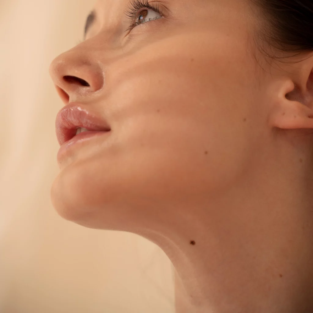 Close-up of a facial skin lesion suitable for cryosurgery at Etica Clinic.