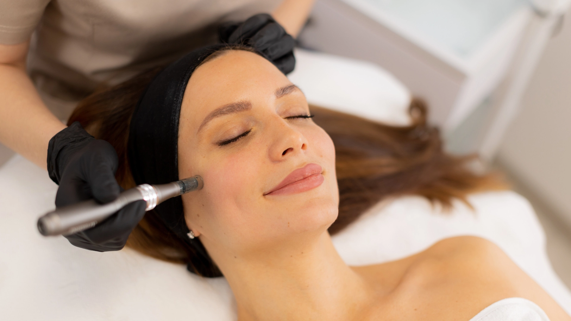 about a client receiving SkinPen microneedling treatment at Etica Beauty Clinic in Eastcote