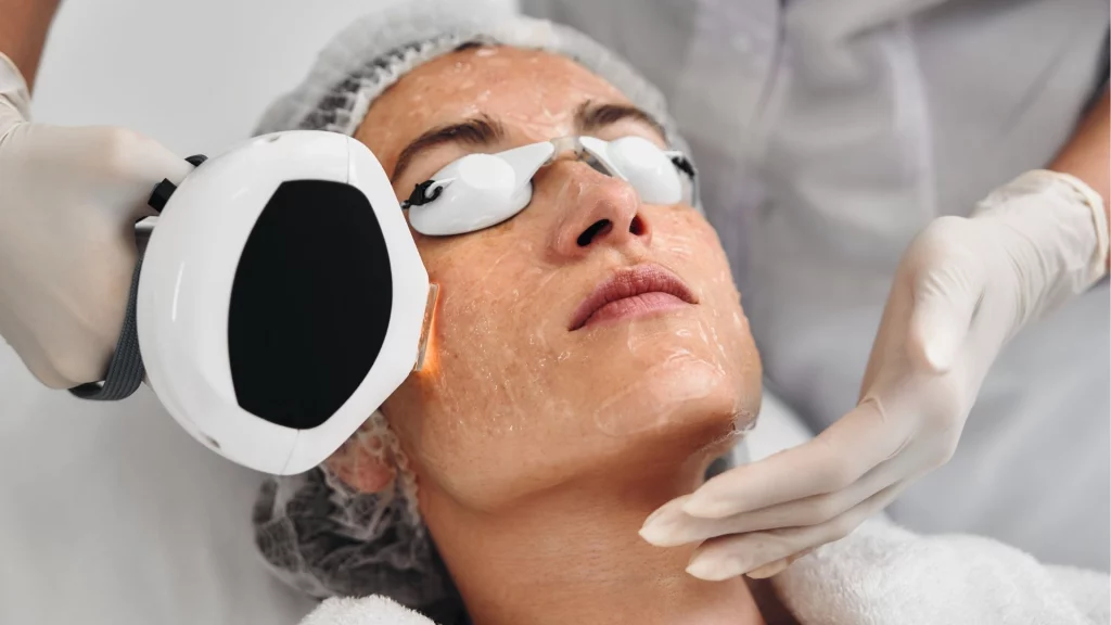 Lumecca IPL treatment in progress at Etica Clinic Eastcote and Northwood.
