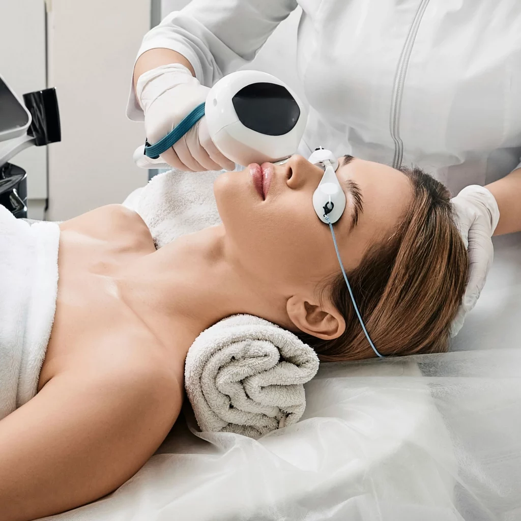 Lumecca IPL treatment at Etica Beauty Clinic for pigmentation and redness